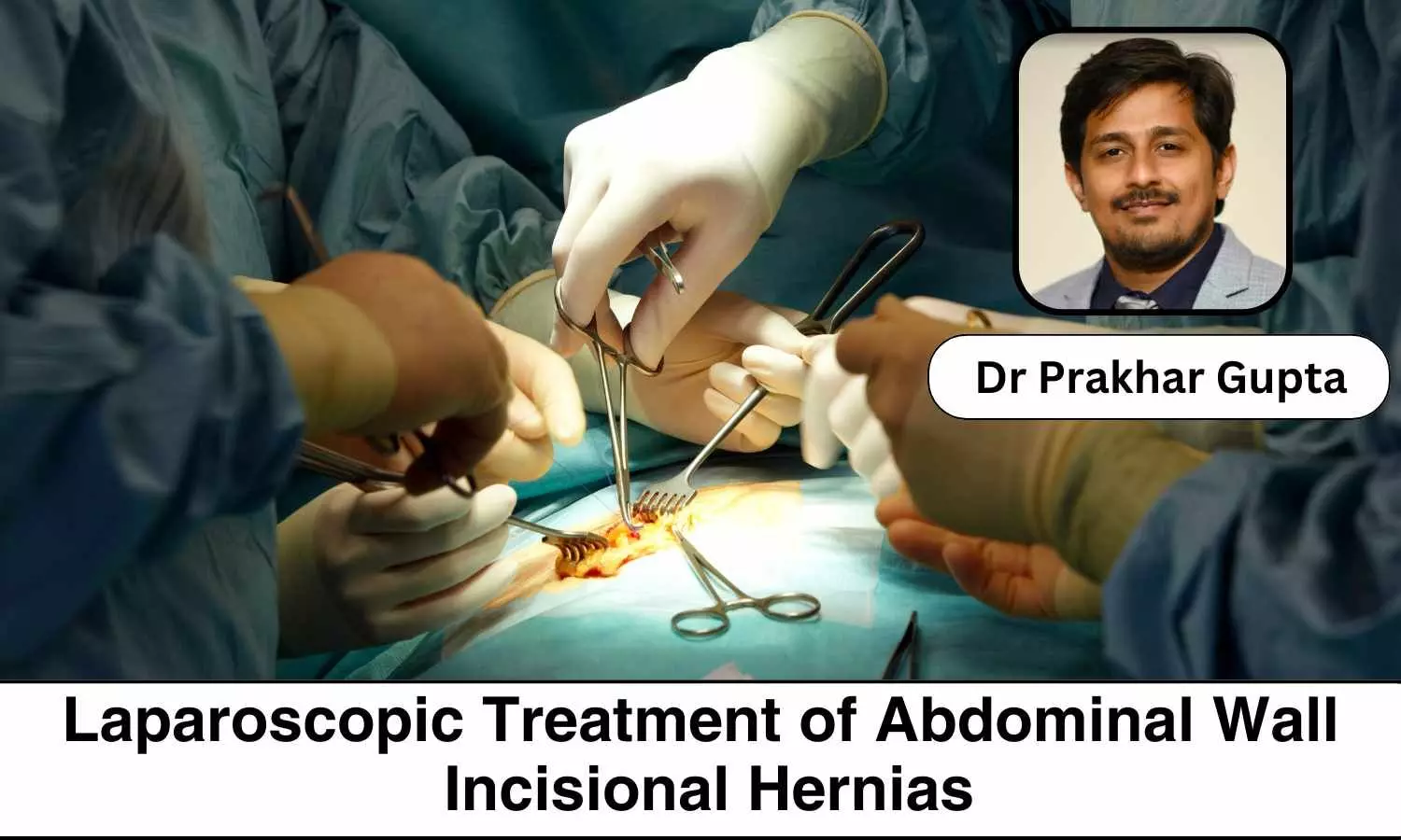 Laparoscopic Treatment of Abdominal Wall Incisional Hernias- Dr Prakhar Gupta