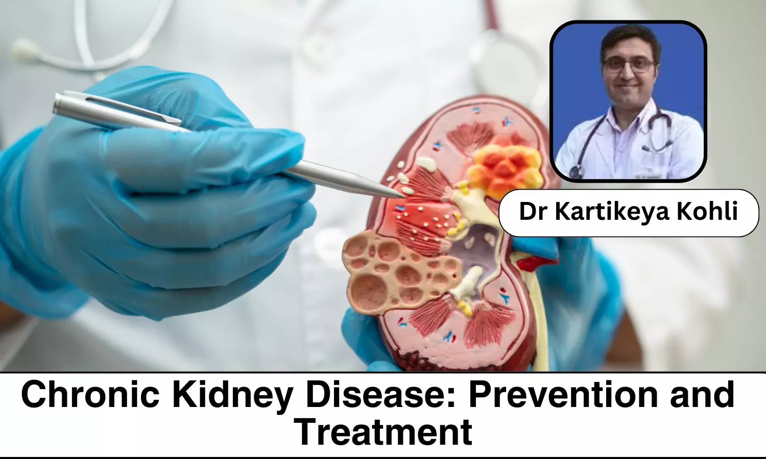 Understanding Chronic Kidney Disease: Prevention and Treatment Options - Dr Kartikeya Kohli