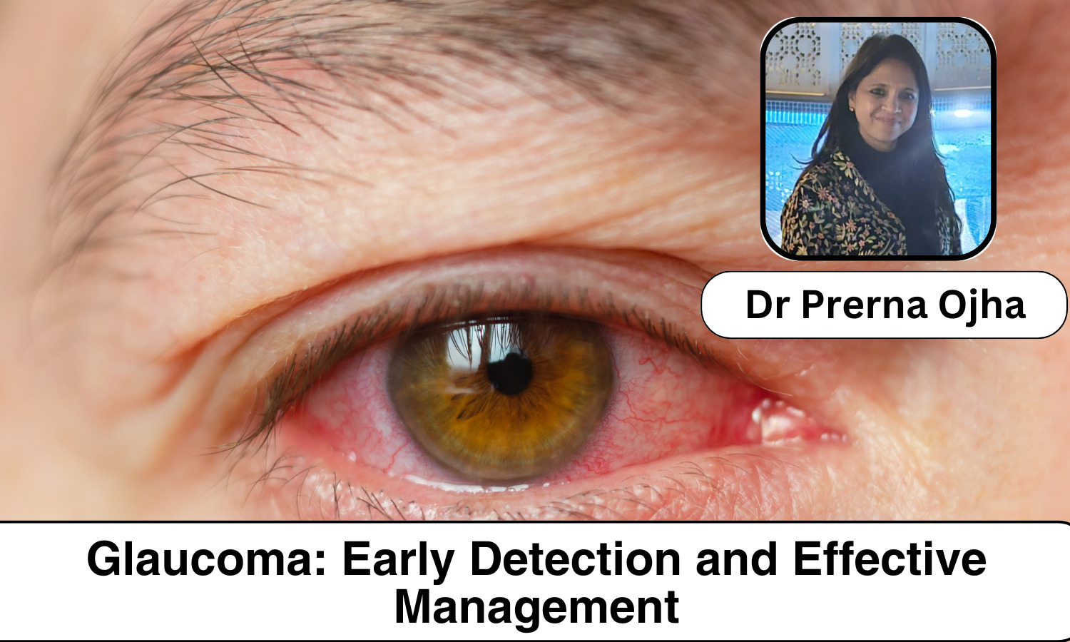 Understanding Glaucoma: Early Detection and Effective Management - Dr ...