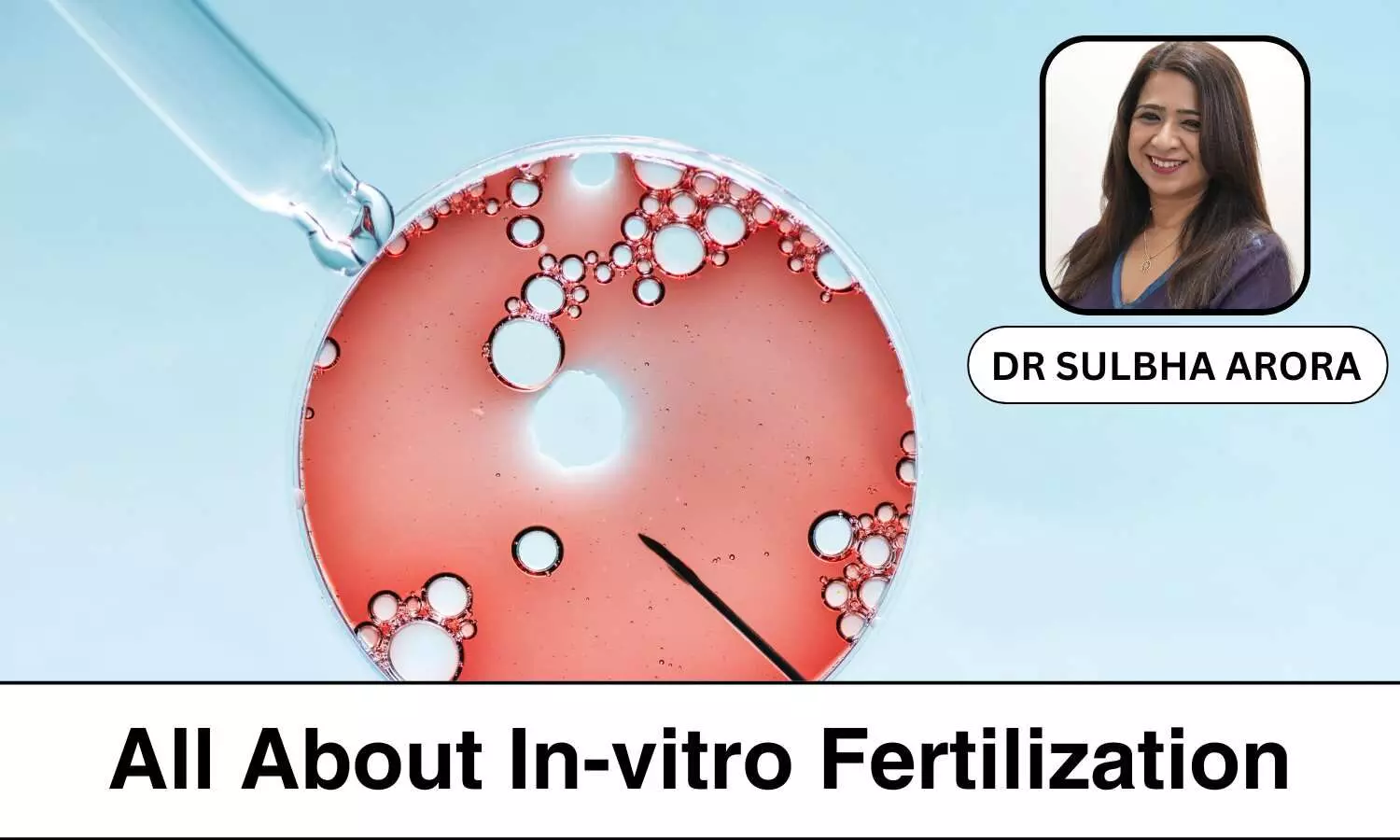 Everything you need to know about In-vitro Fertilization - Dr Sulbha Arora