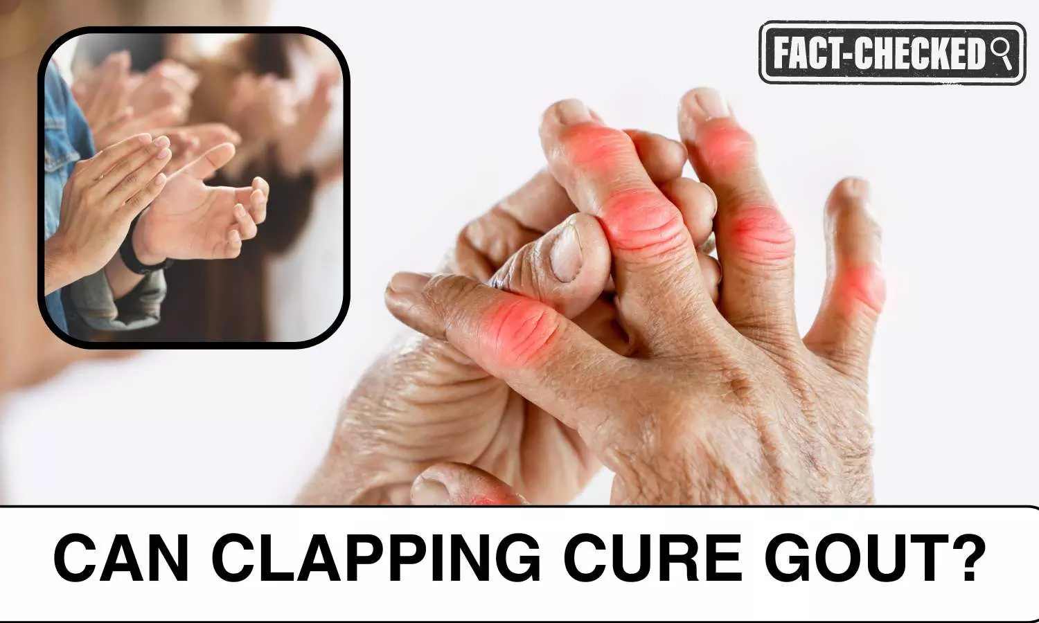 Fact Check: Can Clapping Cure Gout?