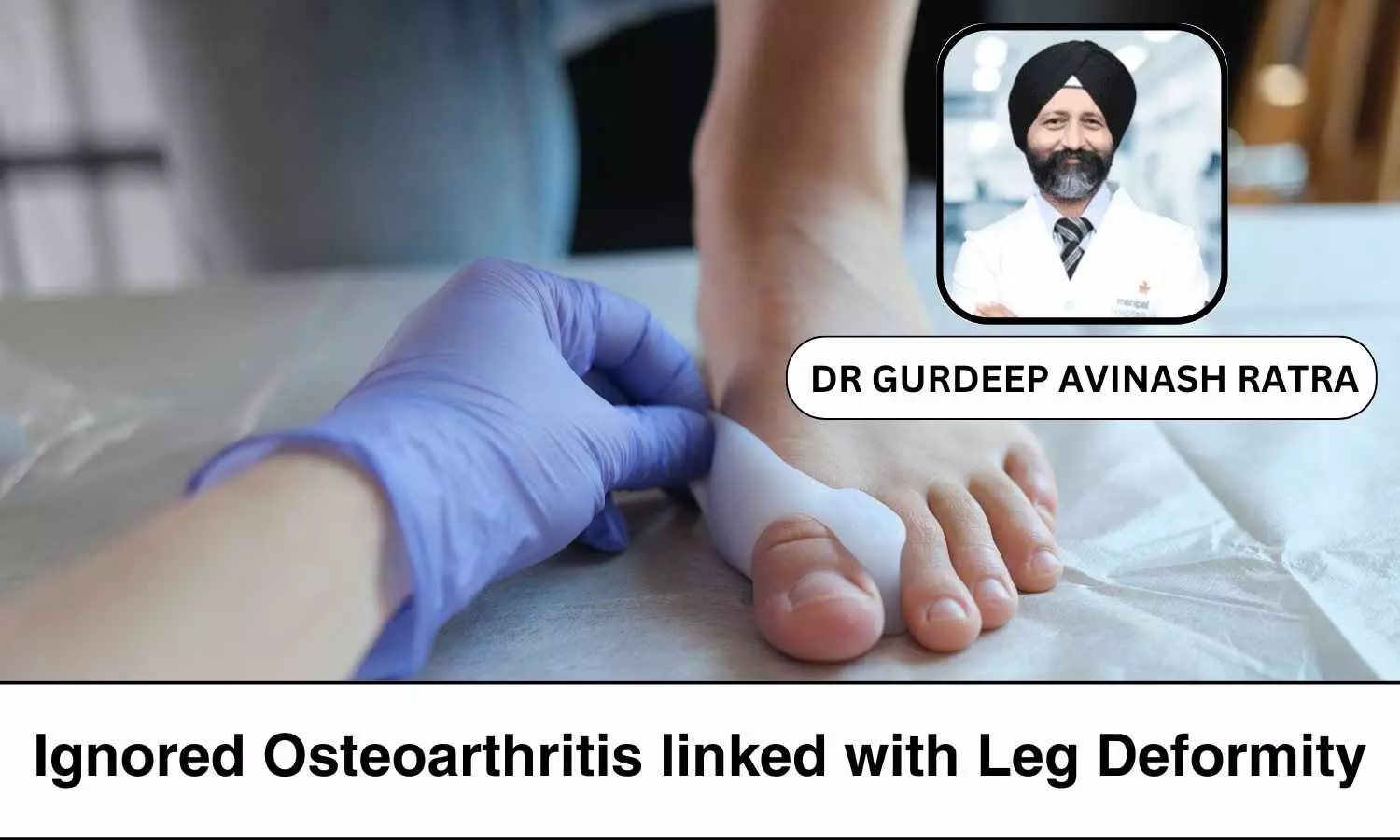 How Ignoring Osteoarthritis Can Cause Leg Deformities? - Dr Gurdeep Avinash Ratra