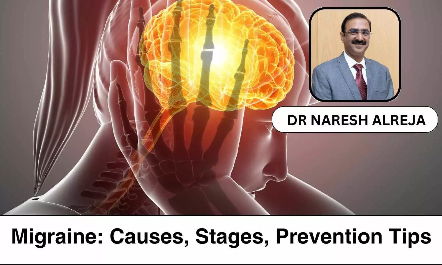 Understanding Migraine: Causes, Stages, Prevention Tips - Dr Naresh Alreja