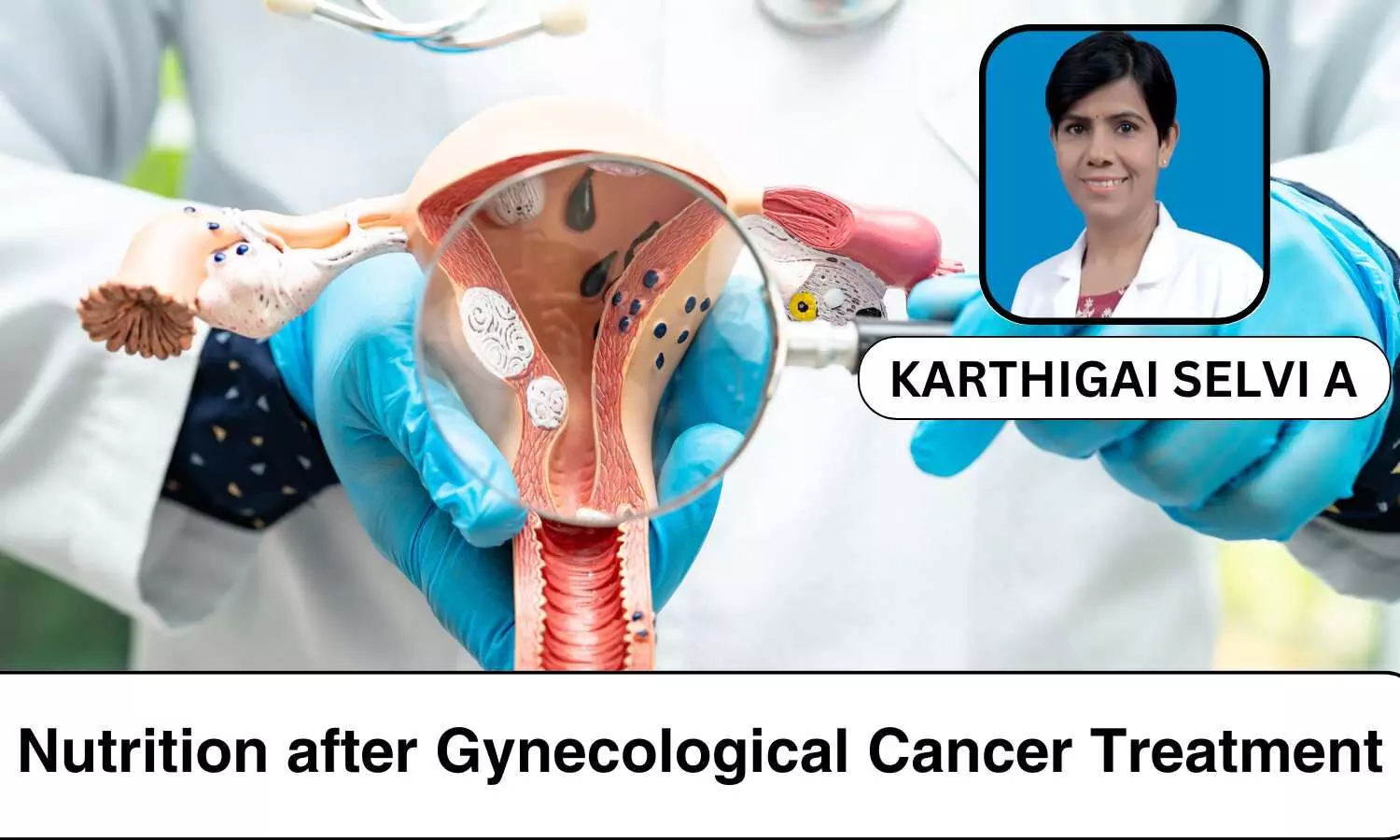 Nutrition after Gynecological Cancer Treatment: A Vital Component of Recovery - Ms Karthigai Selvi A