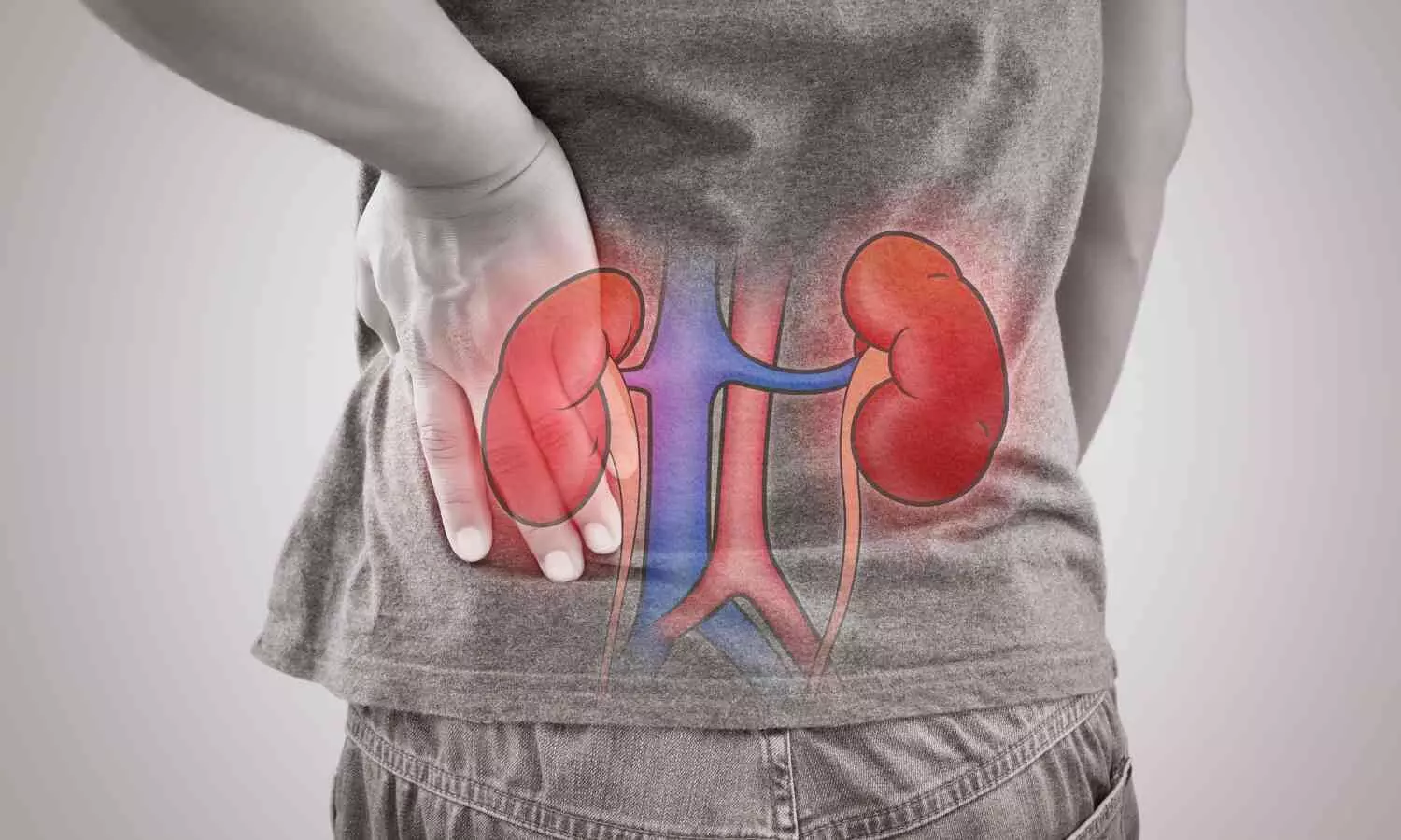 Study Finds 4.9% of Indian Children and Adolescents Suffer from Impaired Kidney Function