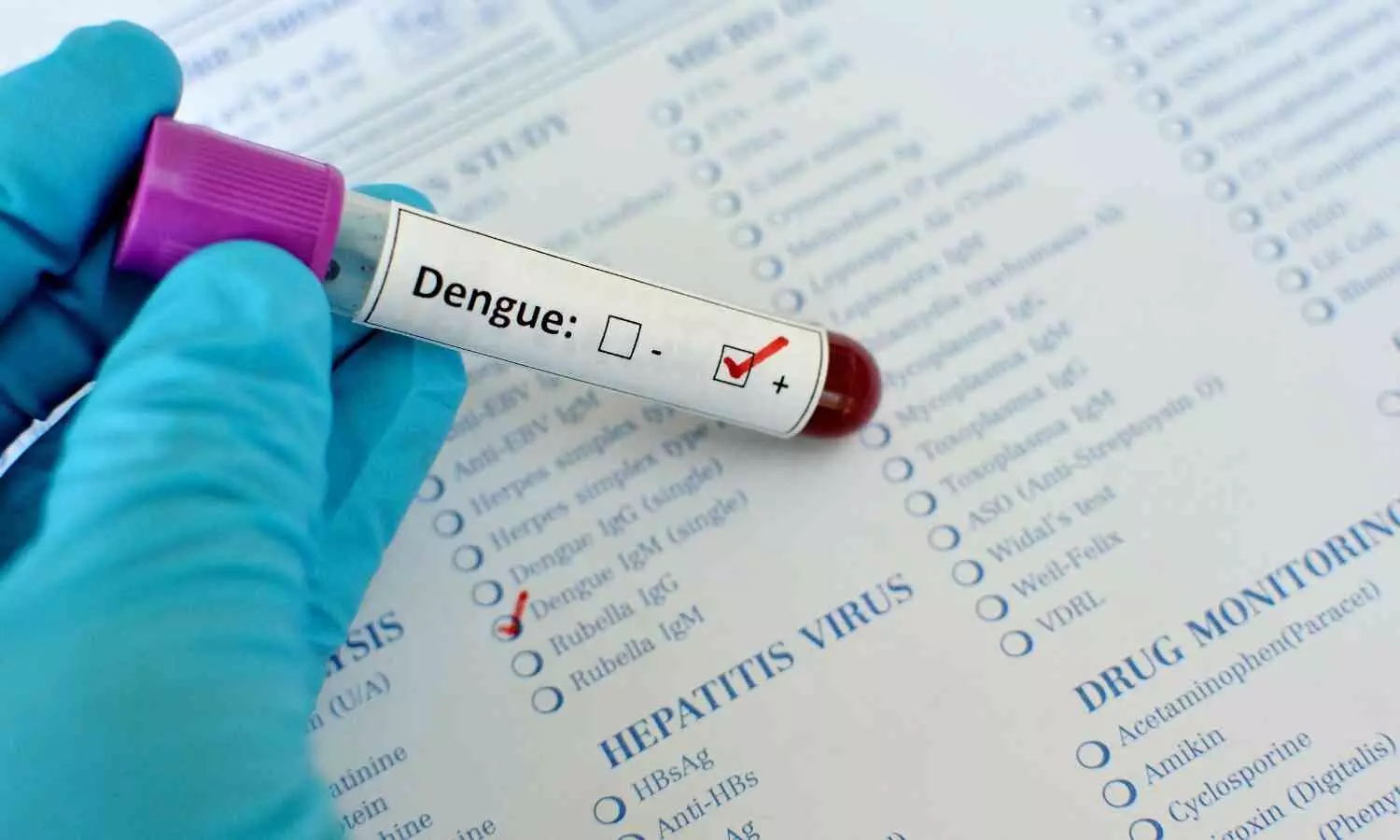 Doctors Warn Dengue Poses Serious Risks to Brain and Nervous System