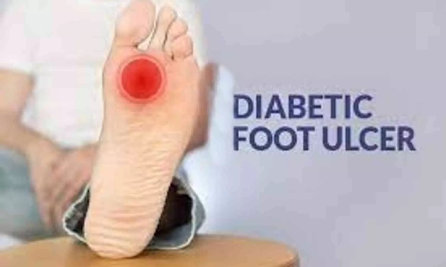 Monsoon Increases Risk of Foot Ulcers in Diabetic Patients: Experts