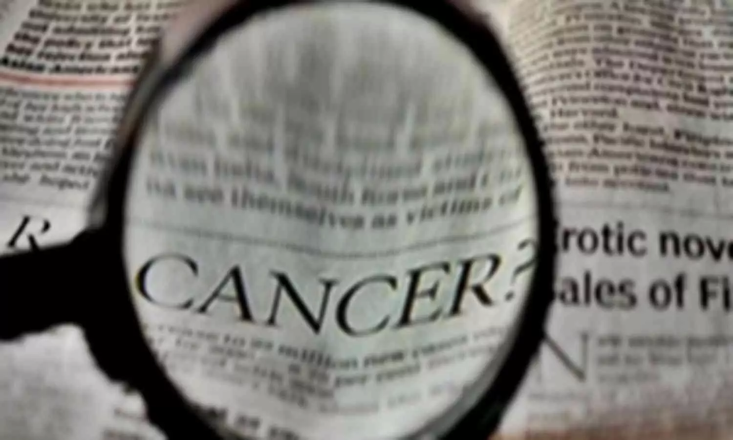 Research indicates delayed diagnosis of cancer is significant issue