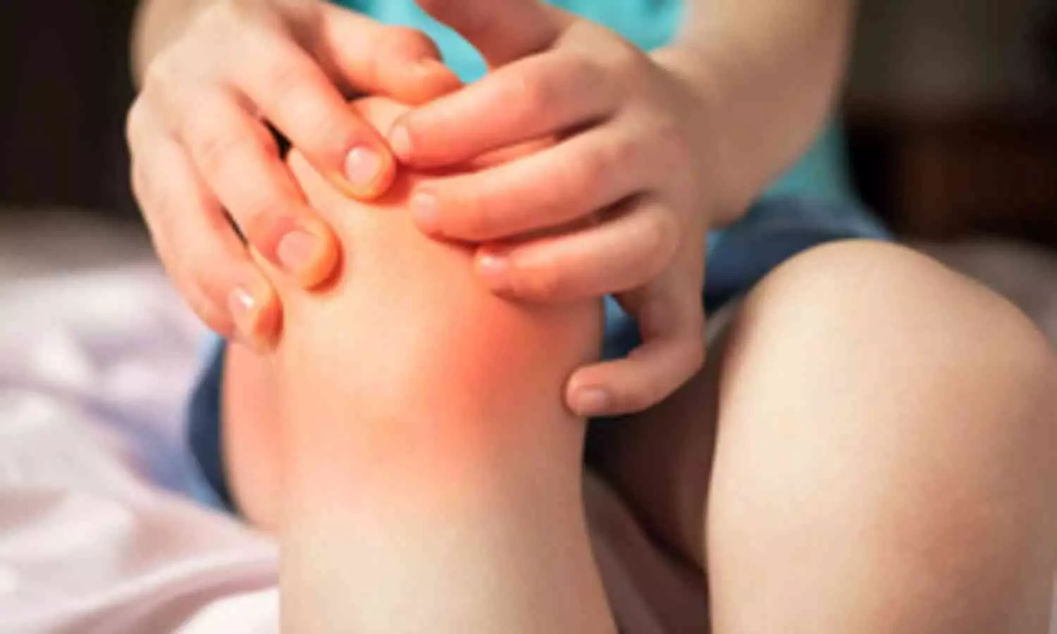 Experts Reveal Higher Prevalence of Juvenile Idiopathic Arthritis in Girls Compared to Boys