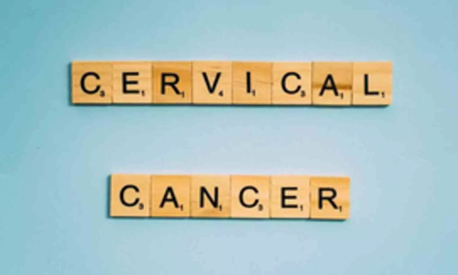 Researchers Develop Enhanced Method for Cervical Cancer Screening