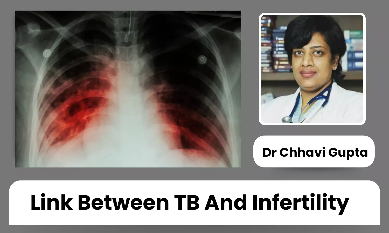 Do You Know TB Can Cause Infertility in Females and Males? - Dr Chhavi Gupta