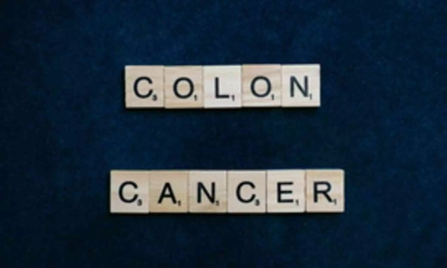 Doctors Raise Alarms Over Increasing Colon Cancer Cases in Adults Under 50