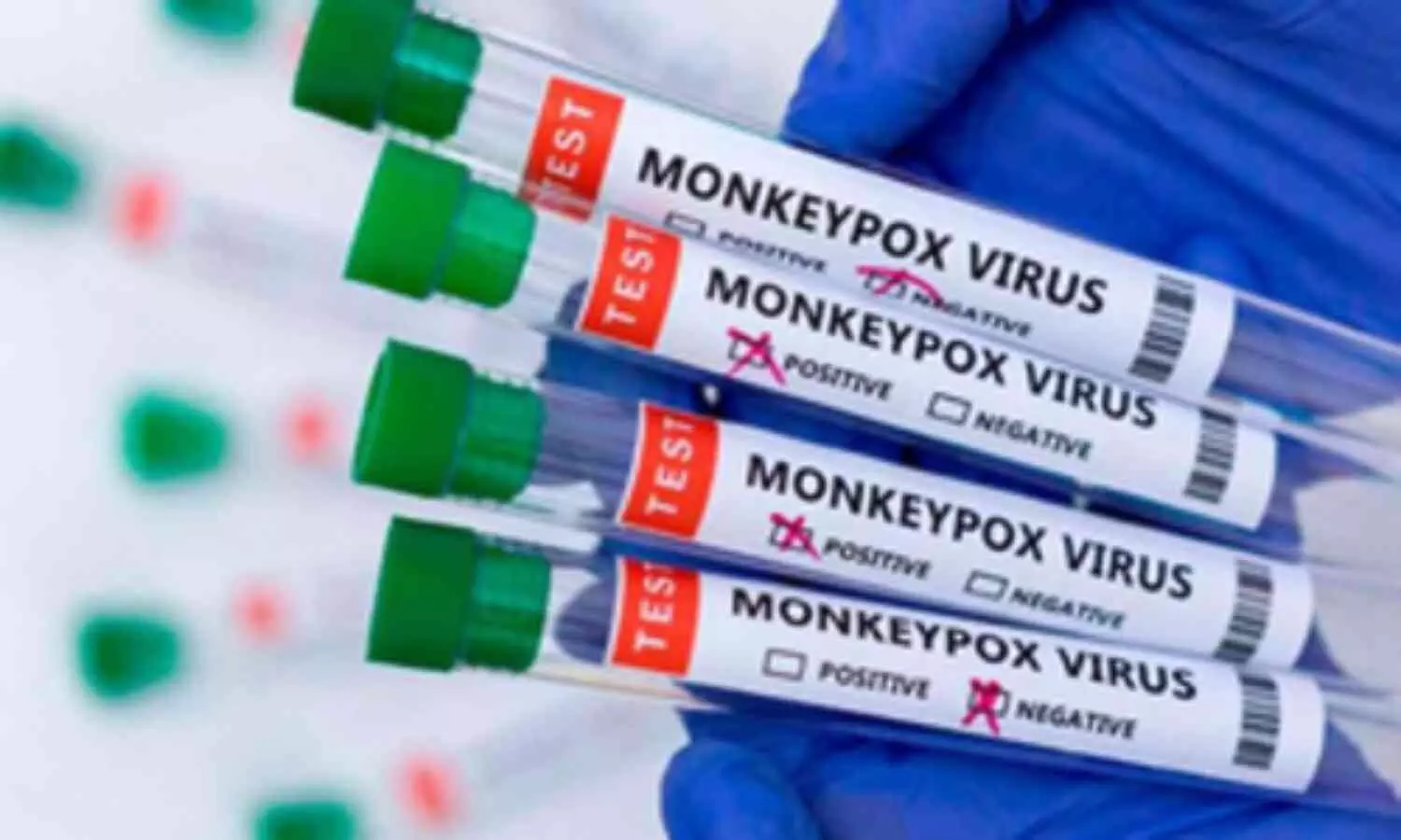 Mpox Virus: Understanding the Latest Global Epidemic