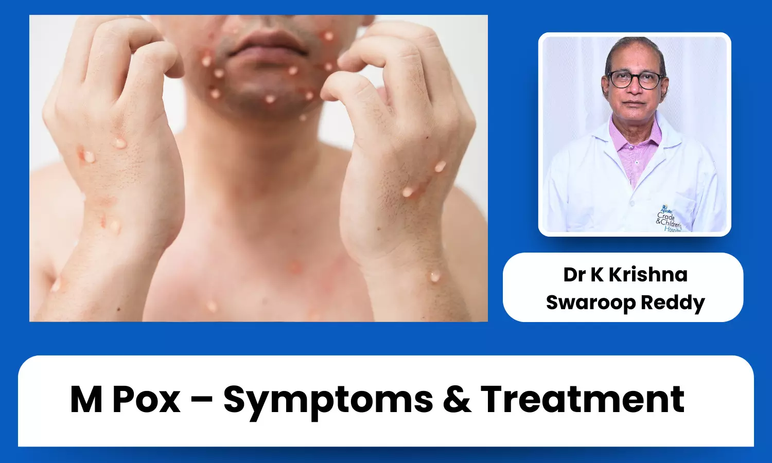 M Pox Explained: Key Symptoms, Transmission Methods, and Treatments - Dr K Krishna Swaroop Reddy