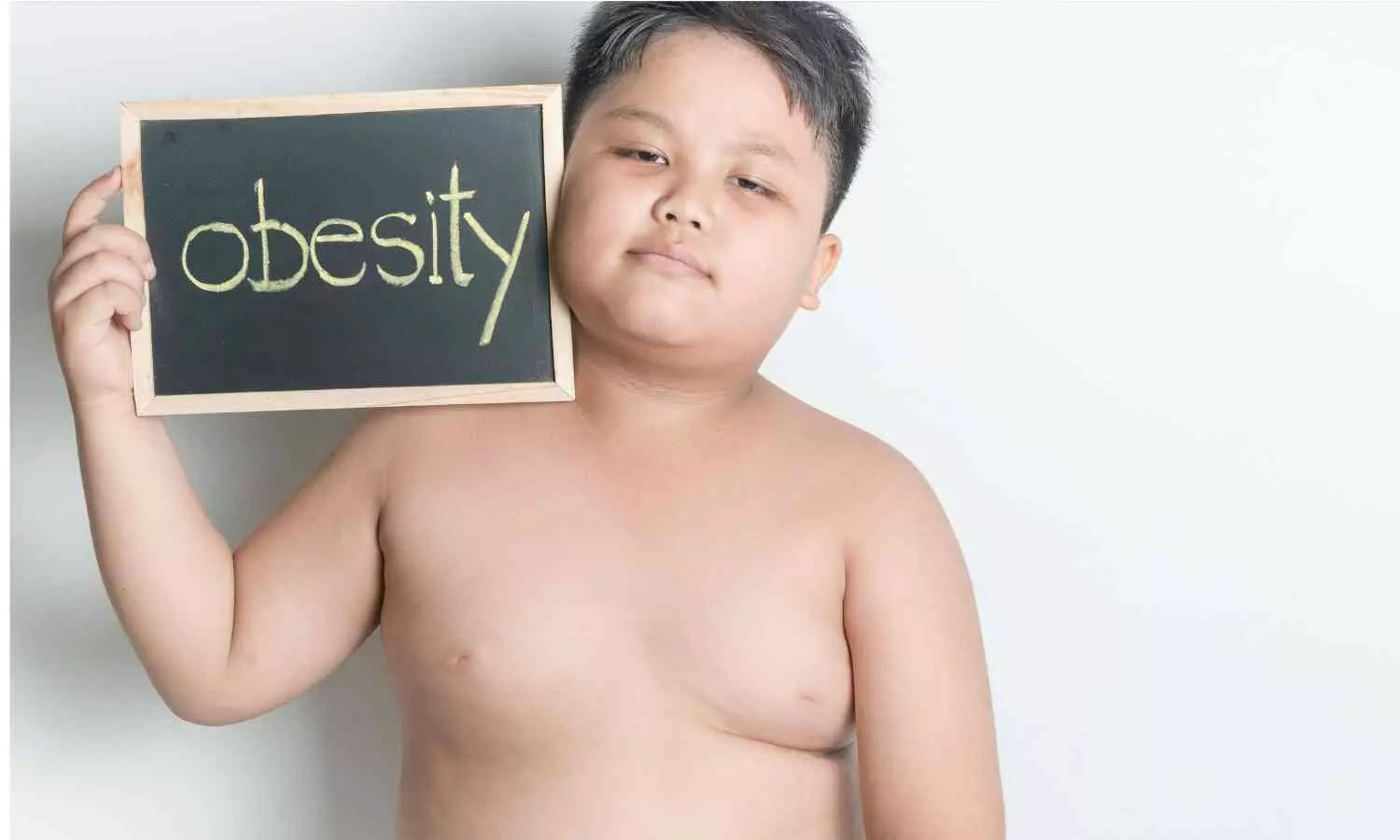 Study Finds Obese Children at Higher Risk for Immune-Related Diseases