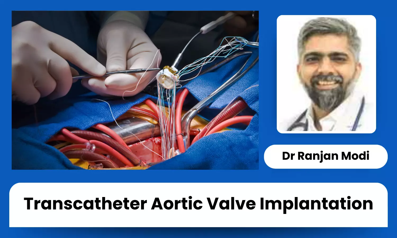 Transcatheter Aortic Valve Implantation (TAVI) and Its Impact on Heart Health - Dr Ranjan Modi