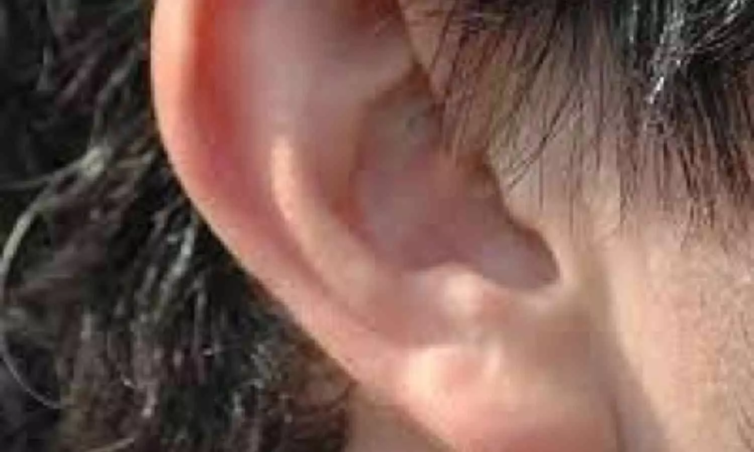 New Portable Device Set to Transform Ear Health Care