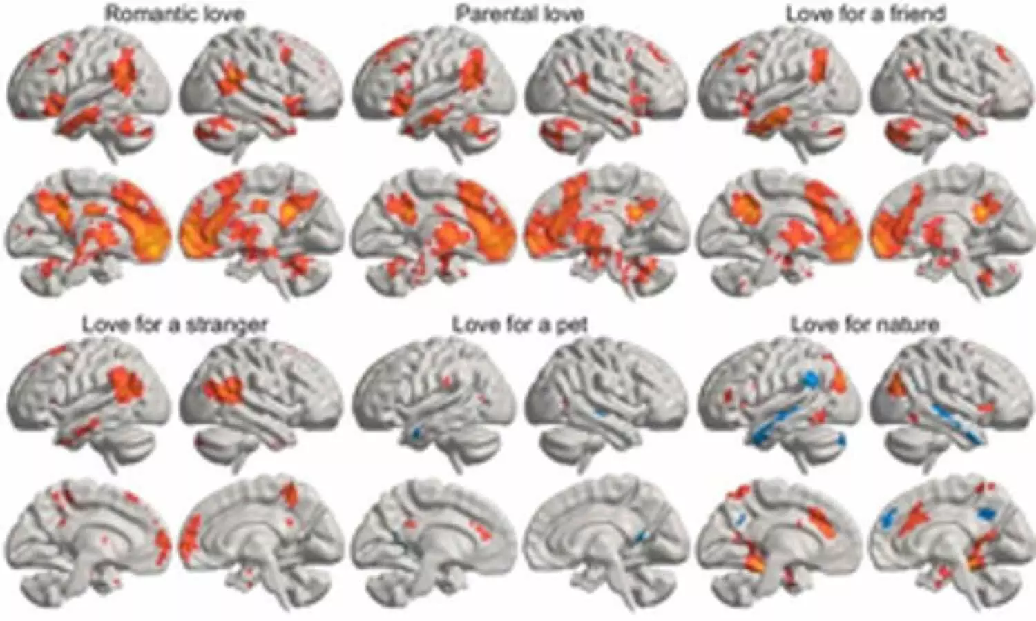 Mapping love: Scientists reveals how love lights up different parts of human brain