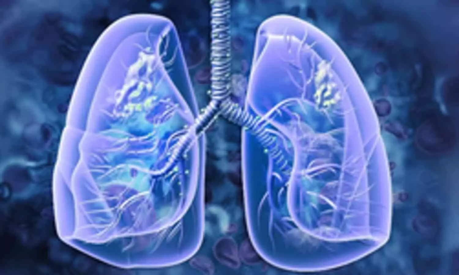 Study Warns: Patients with Preexisting Lung Conditions Face Higher Lung Cancer Risk