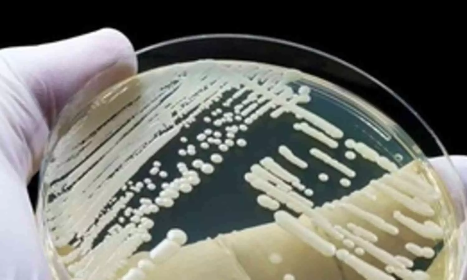 Potentially Fatal Fungal Infection Spreading Across California