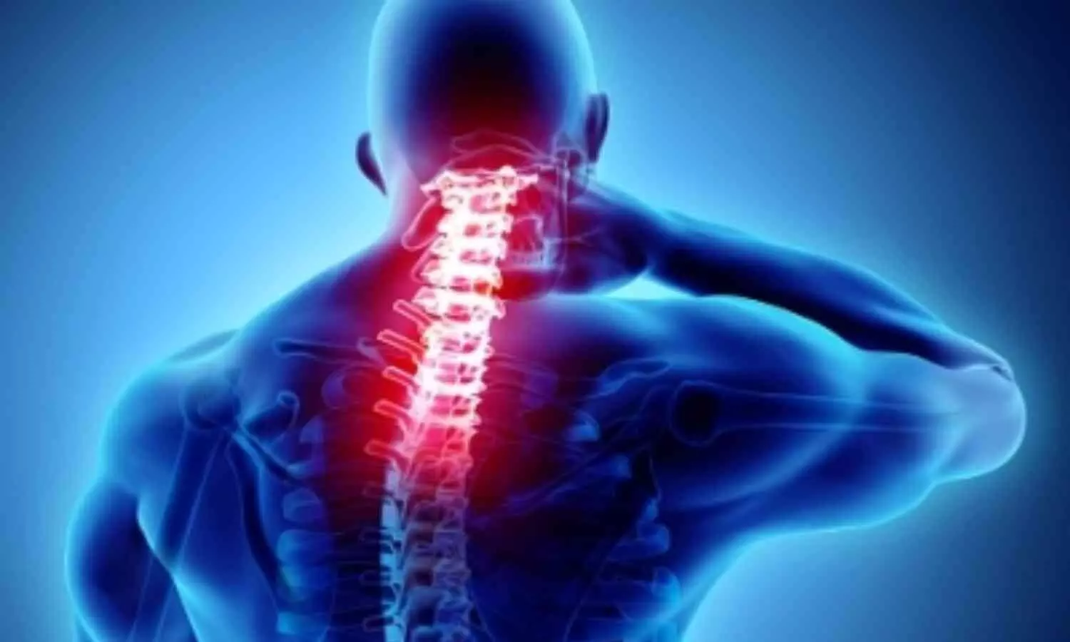 Experts Report Surge in Spinal Cord Injuries