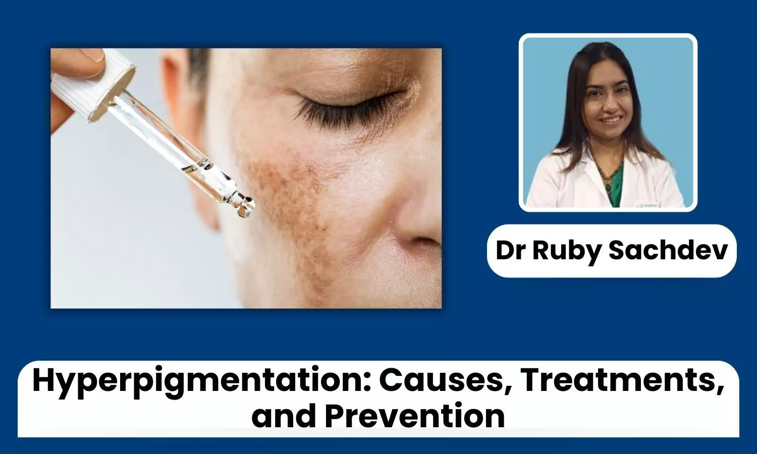 From Sunspots to Melasma: Your Guide to Fading Hyperpigmentation - Dr Ruby Ahuja Sachdev