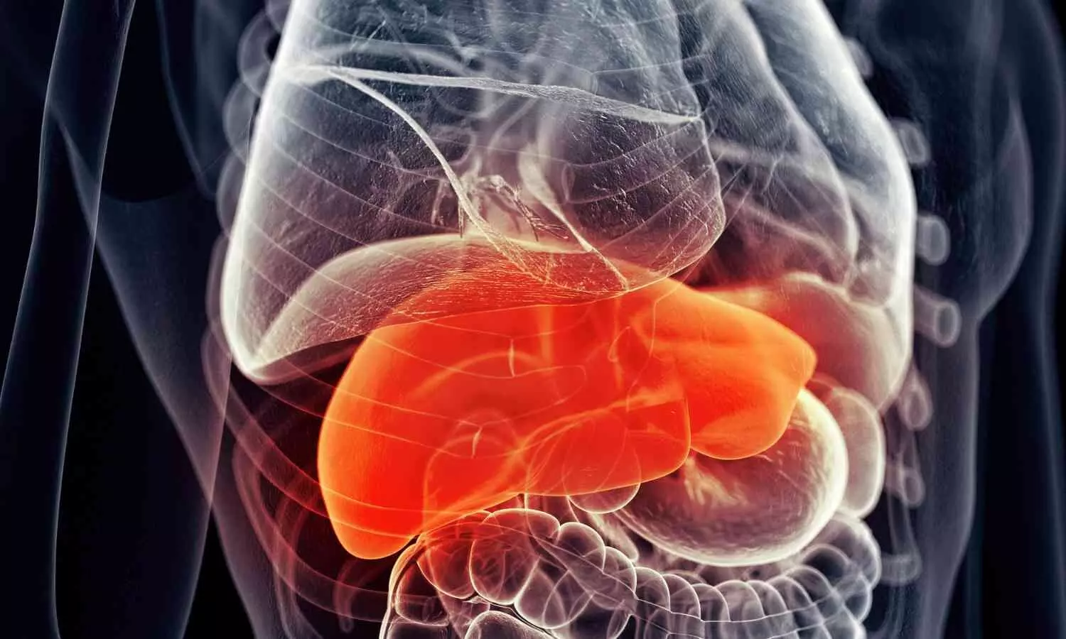 Study Warns Poor Sleep Increases Risk of Cirrhosis in NAFLD Patients