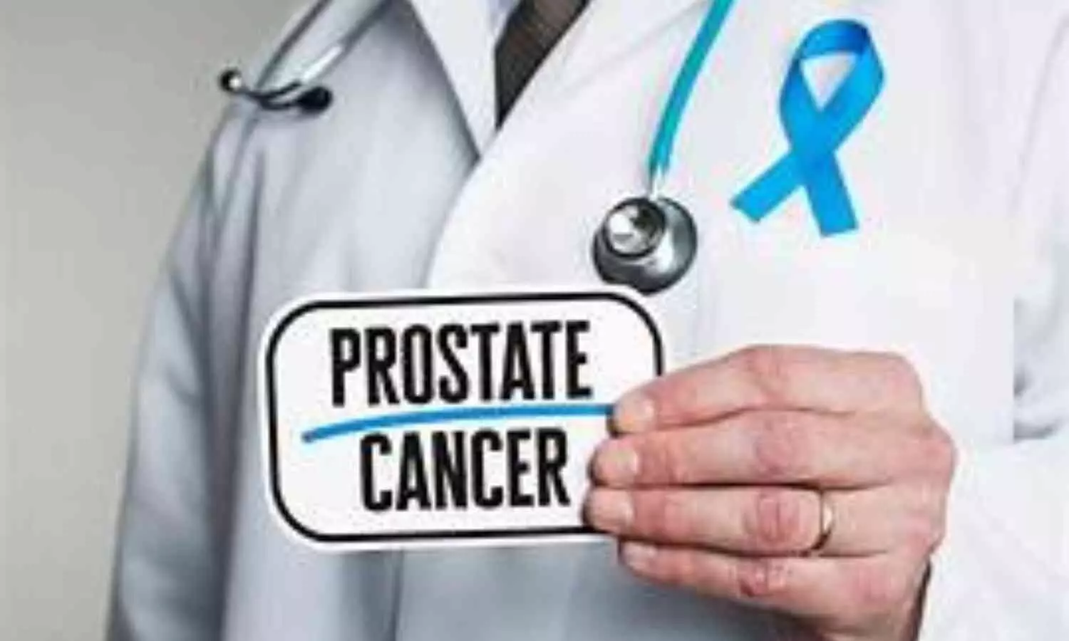 Prostate cancer: A treatable disease burdened by social stigma