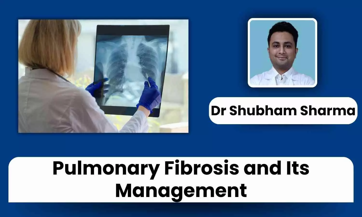 Pulmonary Fibrosis: Causes, Symptoms, and Management Explained - Dr Shubham Sharma