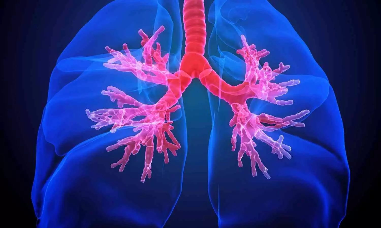 World Lung Day: Why Non-Smokers Are Also Vulnerable to Respiratory Diseases