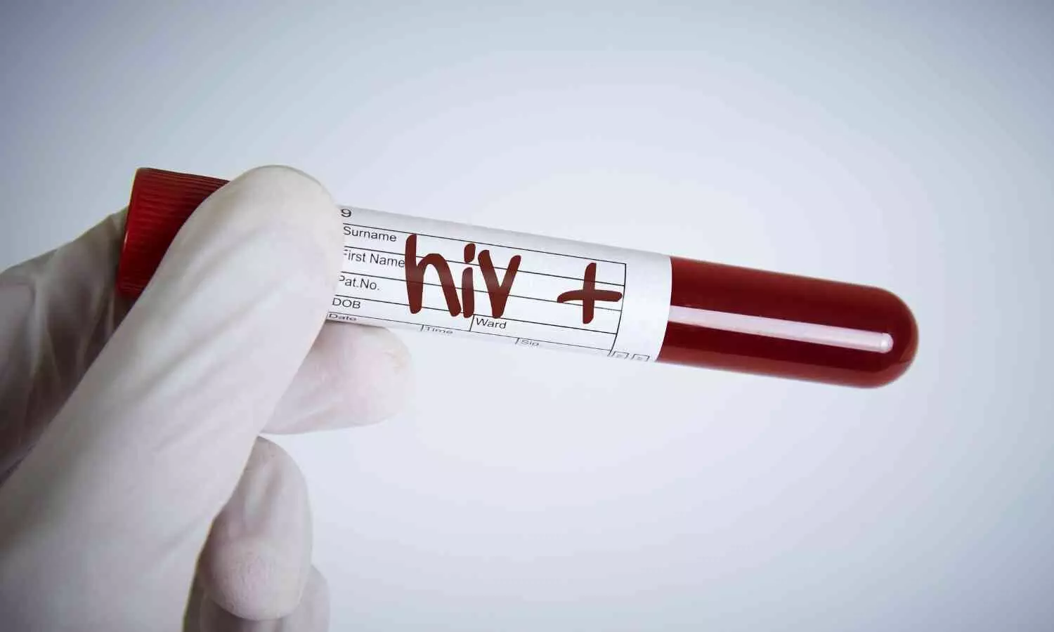 India Sees 44% Decrease in Annual HIV Infections Since 2010, Reports MoS Health