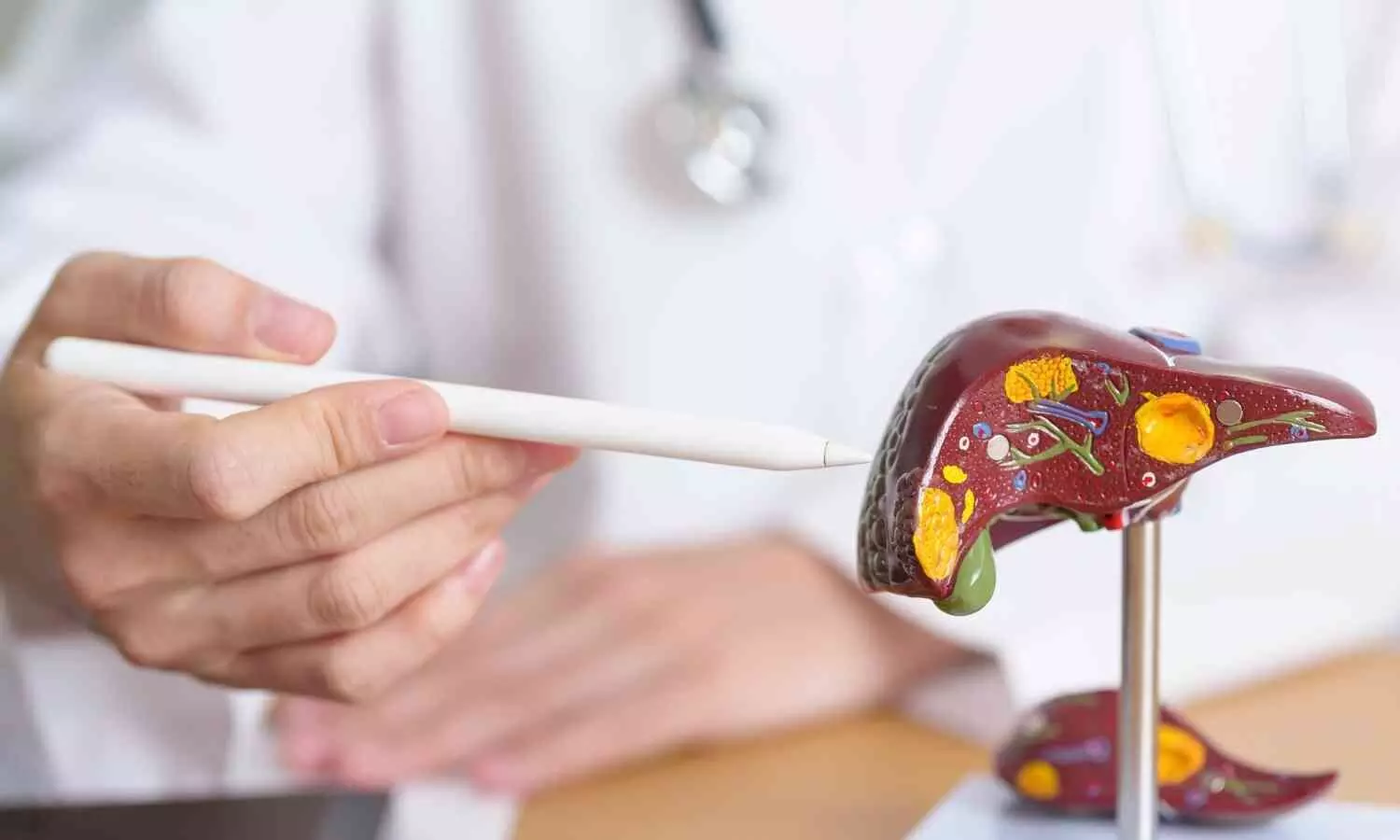 Diabetes and Obesity Linked to Higher Risk of Liver Cancer Recurrence: Study