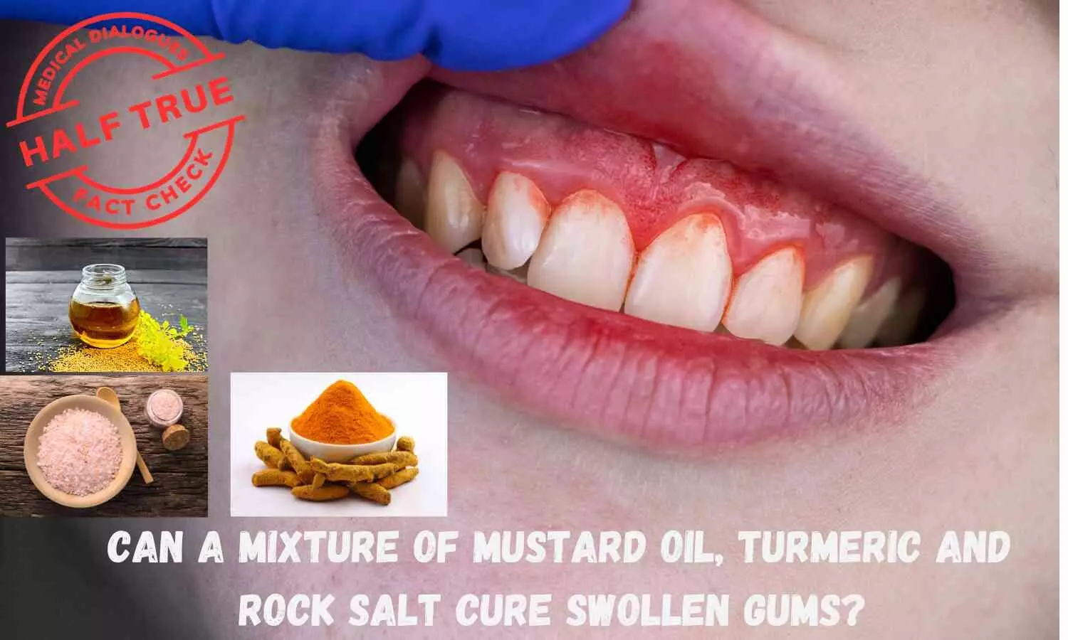 Fact Check: Can a mixture of mustard oil, turmeric and rock salt cure swollen gums?