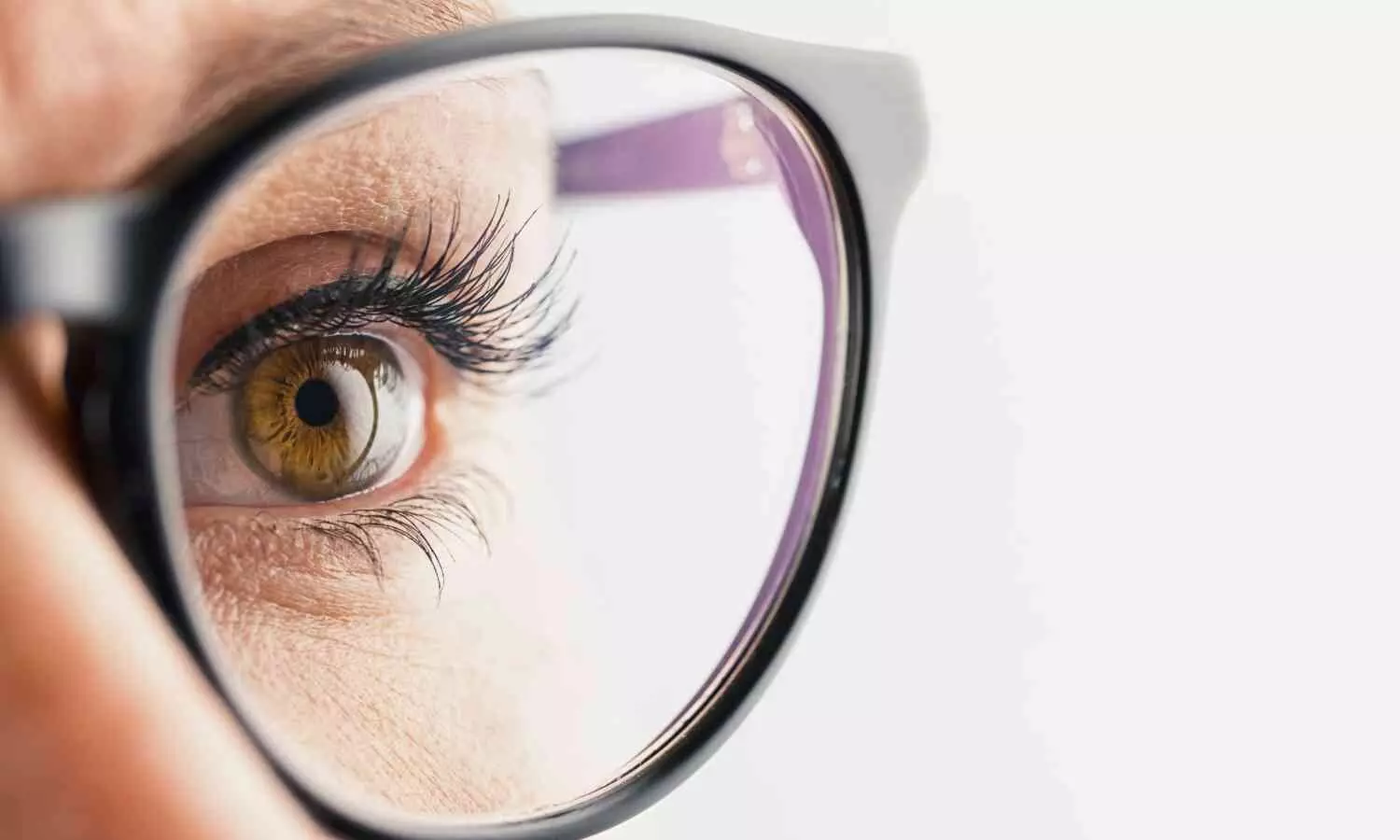 Eye expert warns myopia could affect 50% of the global population by 2050