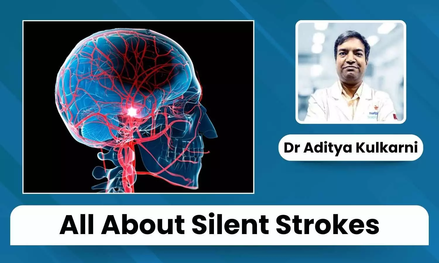 Silent Strokes: Symptoms, Risk Factors, and Importance of Early Detection - Dr Aditya Kulkarni