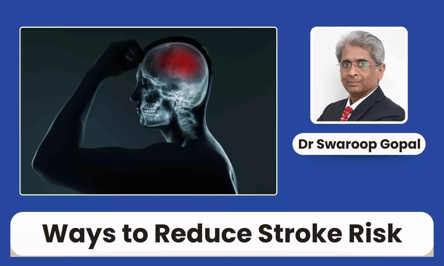 7 Effective Ways to Reduce Your Stroke Risk - Dr Swaroop Gopal