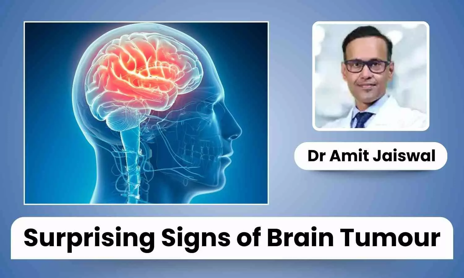 Surprising Signs of Brain Tumour Often Overlooked - Dr Amit Jaiswal