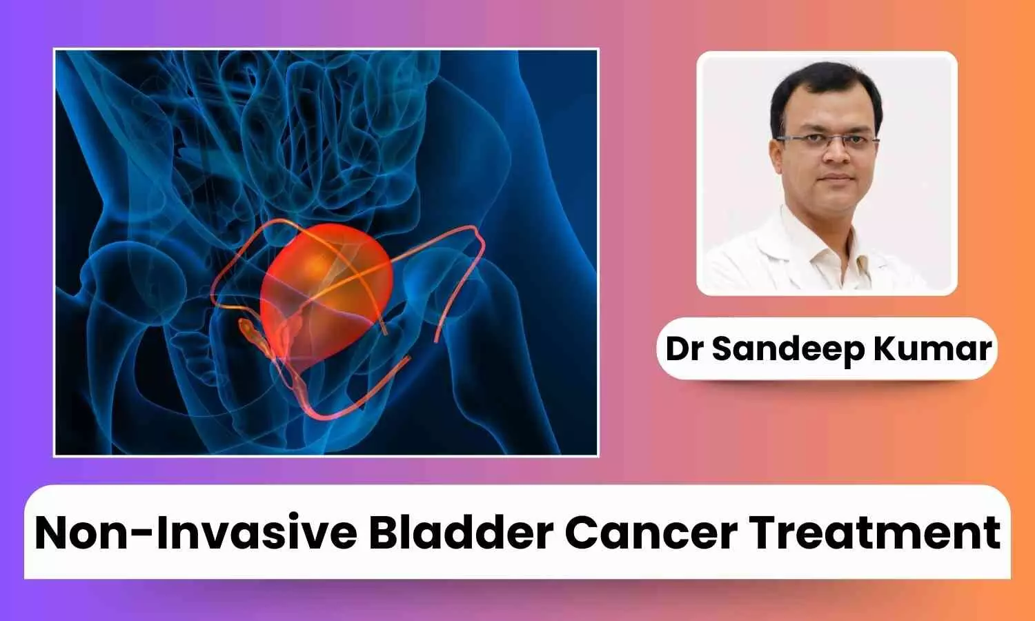 Non-Invasive Bladder Cancer Treatment: High Risk Factors to Know About - Dr Sandeep Kumar