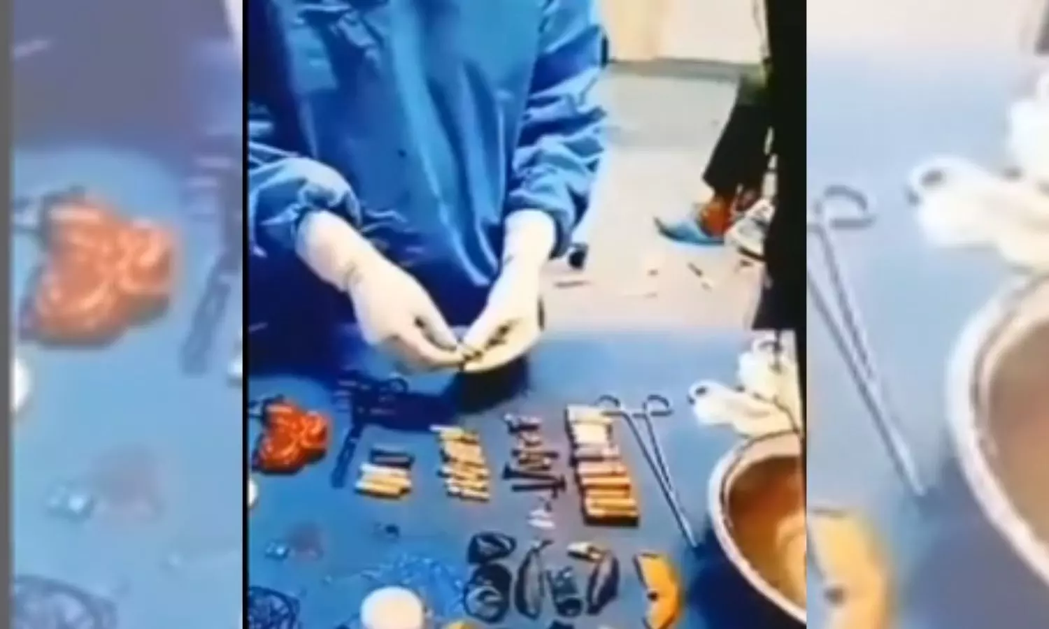 Image of 56 metal objects removed from the boys stomach