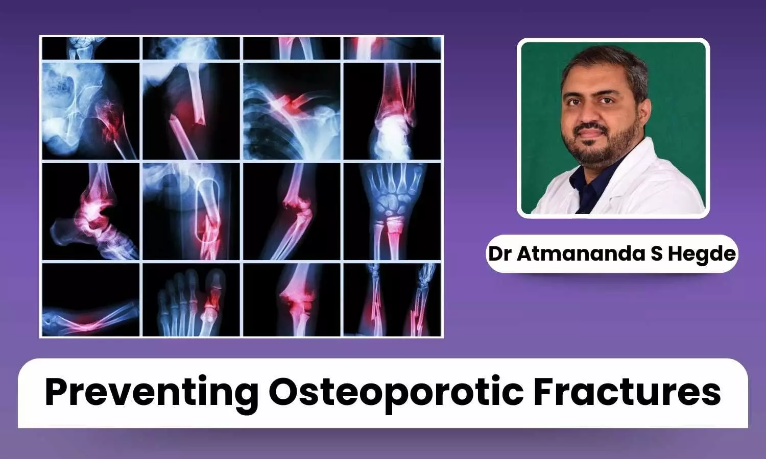 Preventing Osteoporotic Fractures: Safety Tips and Fall Prevention Strategies - Dr Atmananda S Hegde