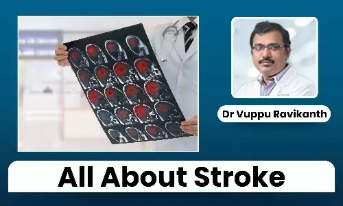 Stroke Overview: Types, Symptoms, Risk Factors, and Recovery Tips - Dr Vuppu Ravikanth Stroke Overview: Types, Symptoms, Risk Factors, and Recovery Tips - Dr Vuppu Ravikanth