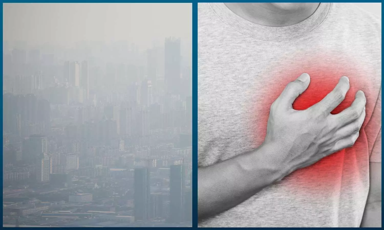 Image representing air pollution and heart failure patient