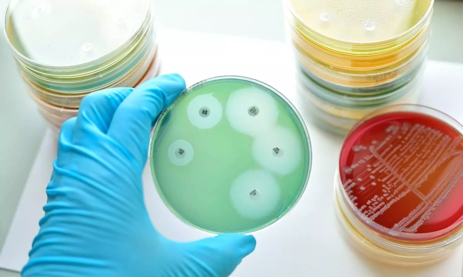 Image representing antimicrobial resistance