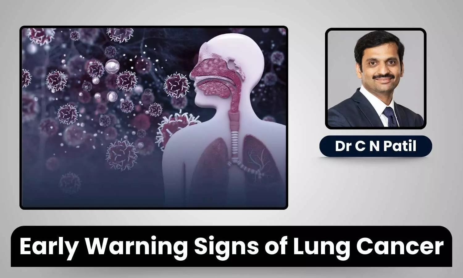 featured image representing lung cancer