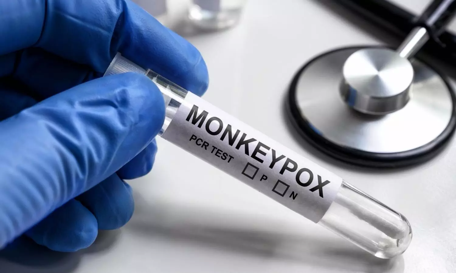 Image representing Monkeypox diagnosis