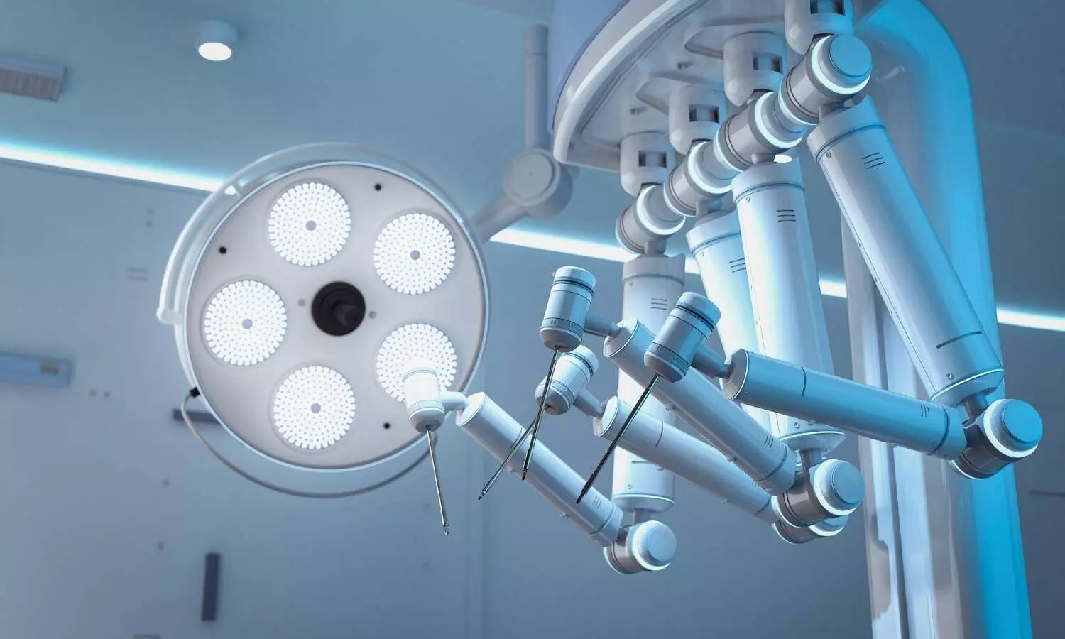 Image representing robotic assisted surgery