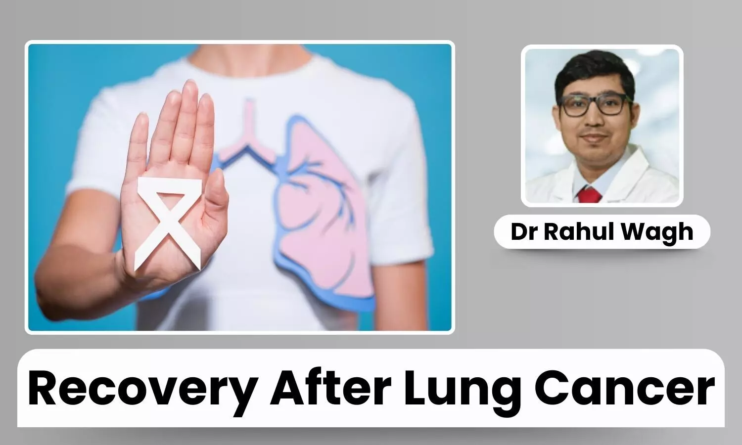 Featured image representing Lung Cancer