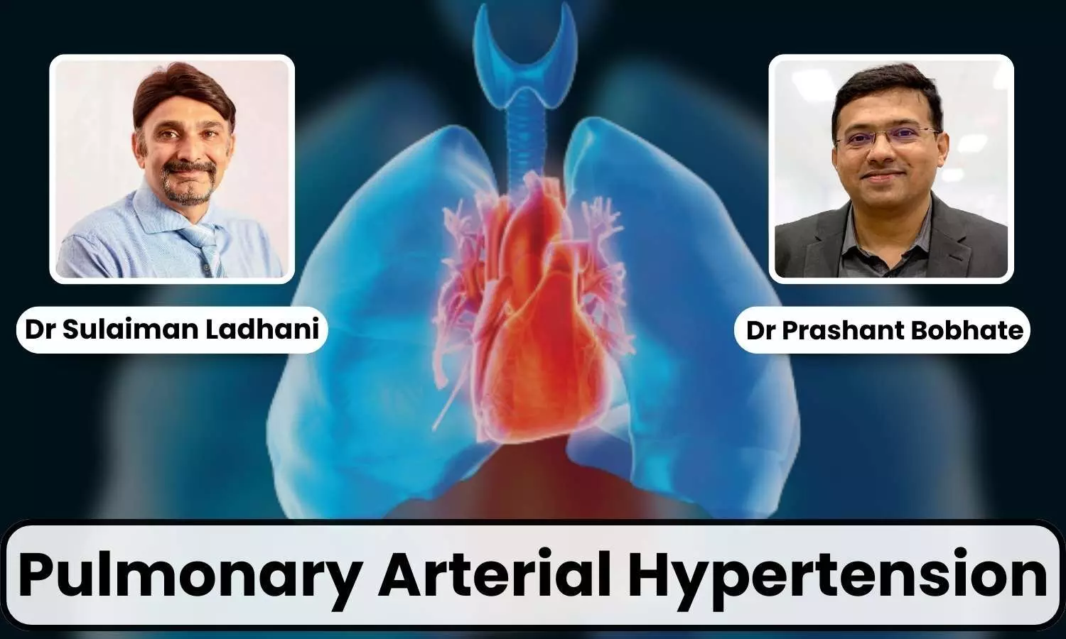 Featured Image representing Pulmonary Arterial Hypertension