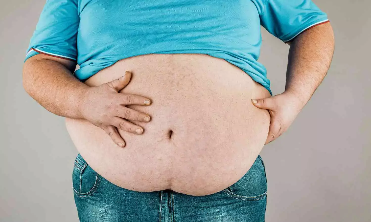 Overweight Population Overtakes Smoking as Top Health Risk in Australia