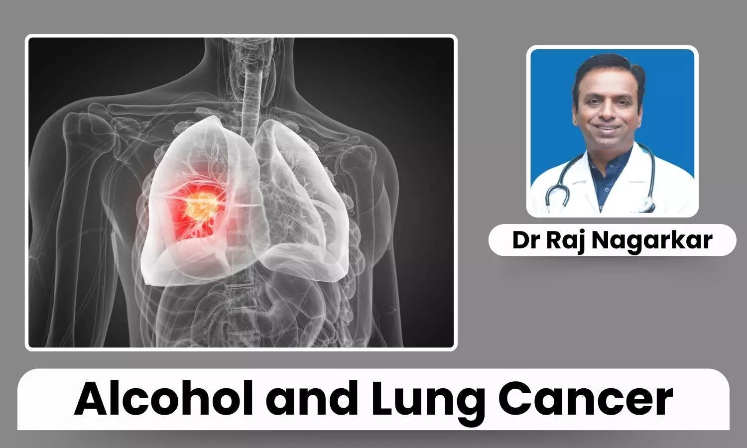 Featured image representing lung cancer